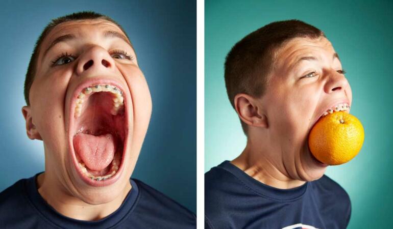 Isaac Johnson, adolescentul cu cea mai mare gură din lume